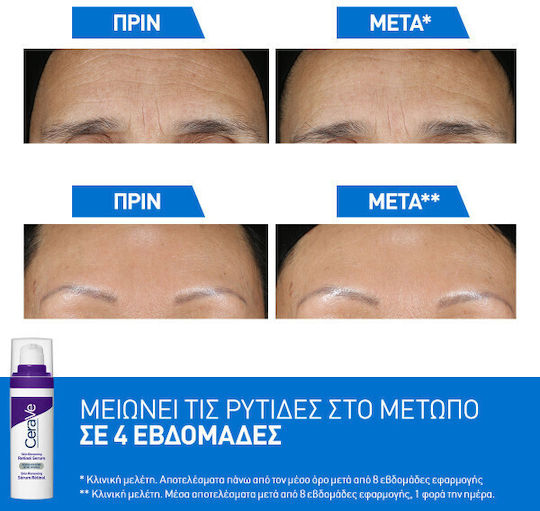 CeraVe Skin Renewing Retinol Anti-Aging Serum Gesicht mit Retinol 30ml