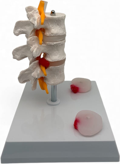Oem Lumbar Spine Medical Training Manikin 17cm White
