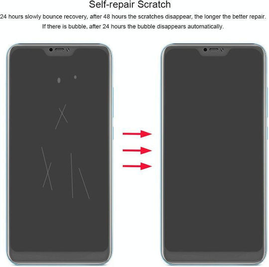 3D 0.1mm Hydrogel Screen Protector (Redmi 6/6a)