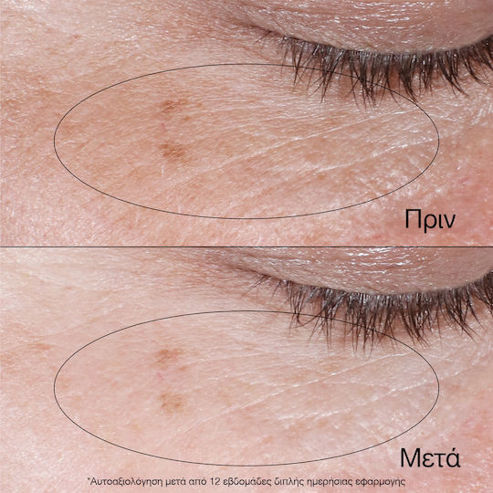 Neutrogena Collagen Bank Revitalizing Eye Gel Cream with Niacinamide & Peptides for Dark Circles & Puffiness 15g