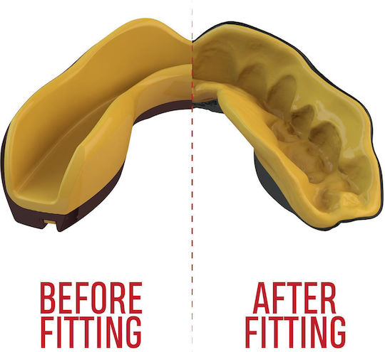 Safejawz Extro Mouthguard Goldie+ Box