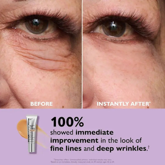 Peter Thomas Roth Instant FIRMx Eye Σετ Περιποίησης για Αντιγήρανση & Σύσφιξη 2τμχ
