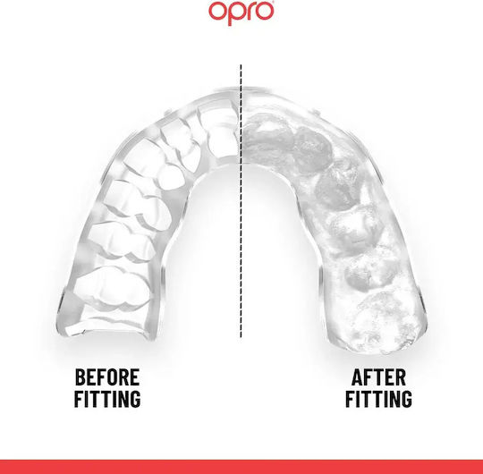 Μασέλα Opro Instant Custom Licensed All Blacks Mouthguard Black