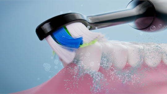 Philips Sonicare Ηλεκτρική Οδοντόβουρτσα με Αισθητήρα Πίεσης και Θήκη Ταξιδίου Λευκή