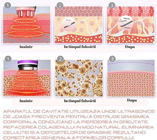 Dispozitiv Profesional Lipolaser Aparat Cavitație