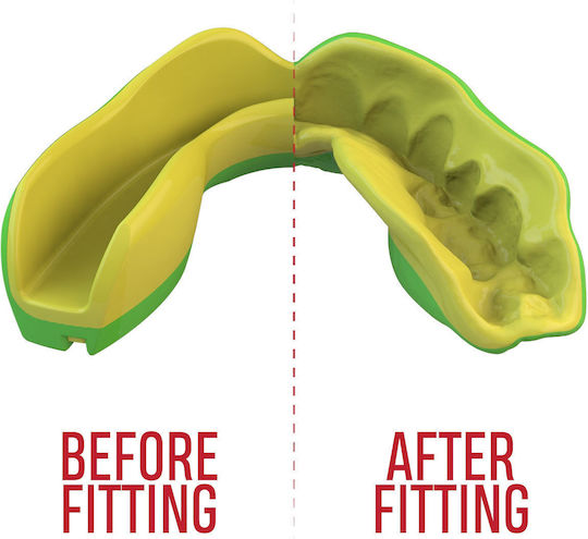 Safejawz Senior Extro 2.0 Ogre Protective Mouth Guard Senior Green with Case