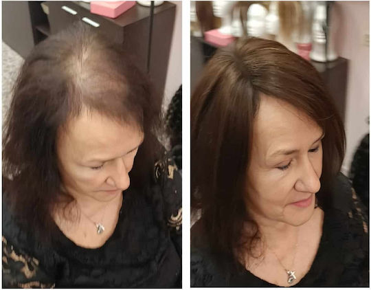 Extension with Human Hair in Light Chestnut Colour 40.64cm Topper Toupee