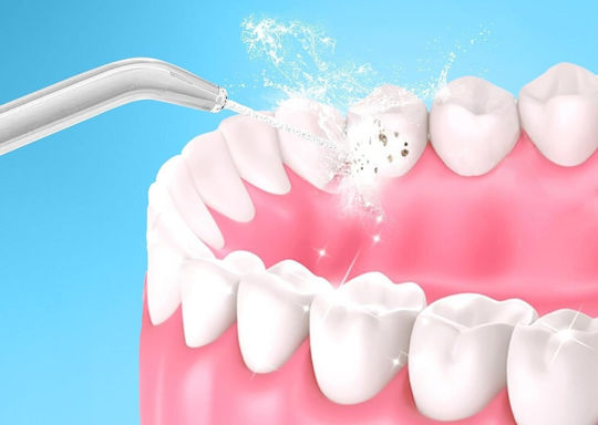 Extralink Water Flosser Μαύρο