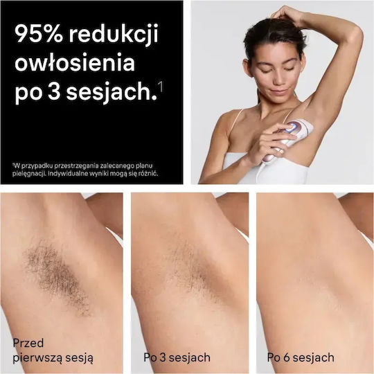 Braun Skin i·expert Hair Removal Set IPL for Face Body & Bikini PL7321