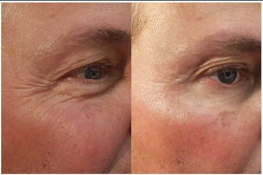 Dermafirm Akne Tagesgesichtscreme 50ml