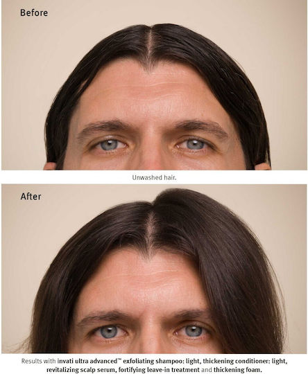 Aveda Invati Ultra Light Σαμπουάν κατά της Τριχόπτωσης 200ml