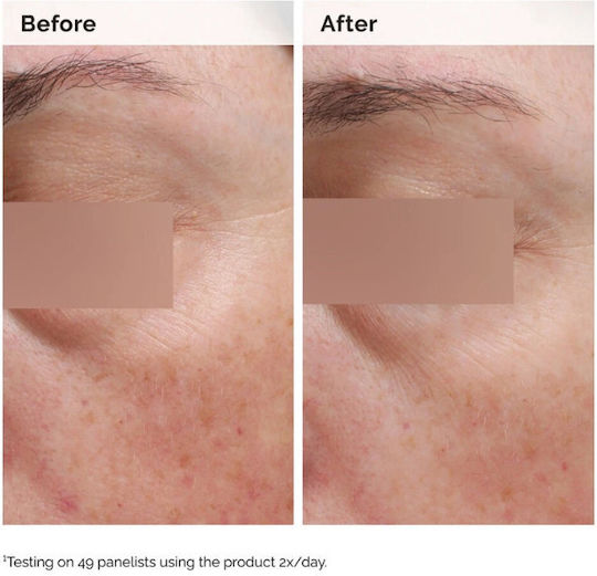 The Ordinary Niacinamide 5% Moisturizing Body Serum against Dark Spots with Niacinamide 100ml
