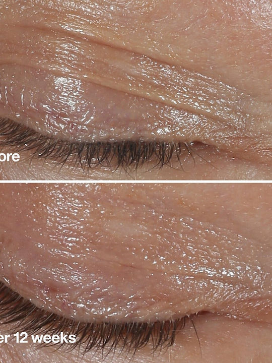 Clinique Wrinkle Fighting Routine Skin Care Set for Anti-ageing