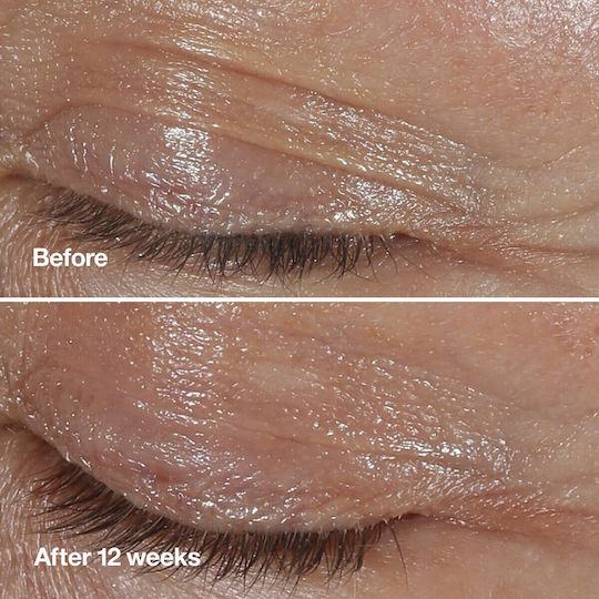 Clinique Wrinkle Fighting Routine Σετ Περιποίησης για Αντιγήρανση