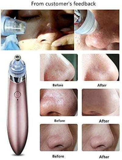 QL-605 Face Care Device White