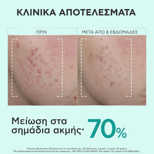 Apivita Bee Tech Concentrates Just Bee Clear Serum Face with Salicylic Acid for Acne & Imperfections 30ml