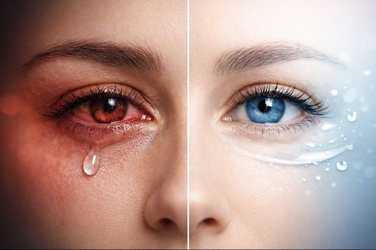 Ophthalmogen Eye 10 Επίθεμα για τα Μάτια 10τμχ