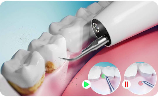 Ultrasonic Scaler Tooth Camera 4 Modes Tartar Removal Led Berdsen Bd-250