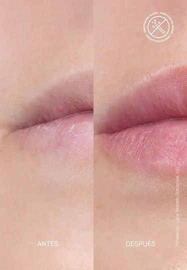 Transparent Lab Volume Hydrating Lip-plumping Treatment 15 Ml Volumizing Lip Serum