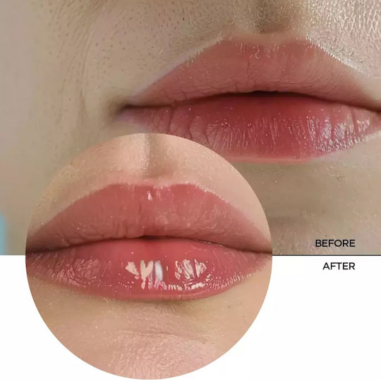 Revox Hyaluronic Acid Lip Filler Lippen Creme Hyaluronic Acid 12ml
