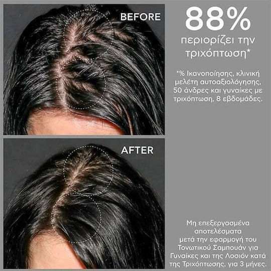 Apivita Tonic Σαμπουάν κατά της Τριχόπτωσης για Όλους τους Τύπους Μαλλιών 500ml