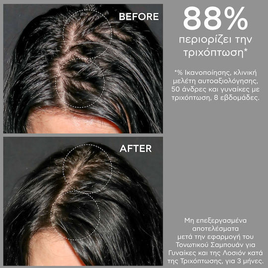 Apivita Tonic Σαμπουάν κατά της Τριχόπτωσης για Όλους τους Τύπους Μαλλιών 75ml