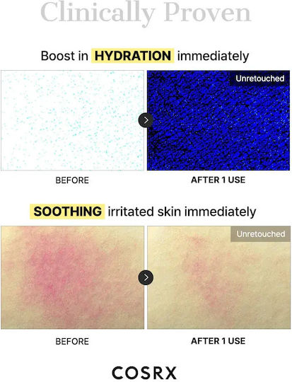 Cosrx Snail Mucin Hydrogel Sheet
