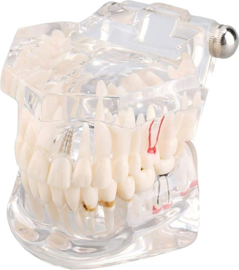 Model Dentar Anatomie Maxilară Dinți