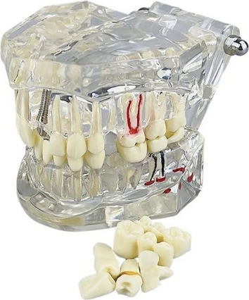 Model Dentar Anatomie Maxilară Dinți