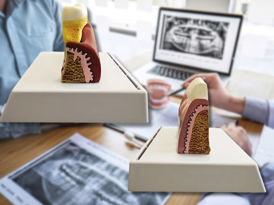 Model Anatomical De Dinți Matriță Model Oral Realist Model Dentar Cabinet Stomatologic Demonstrații Dentare Școală Dentară Bază Dimensiune 16.1 X 12.5 Cm Matriță 13.8 X 8.5 Cm Material Rășină Multicolor