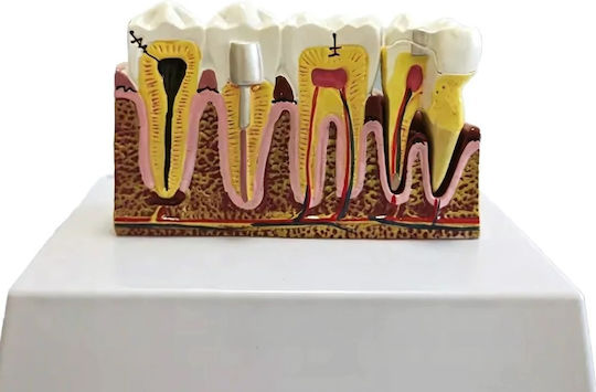 Model Anatomical De Dinți Matriță Model Oral Realist Model Dentar Cabinet Stomatologic Demonstrații Dentare Școală Dentară Bază Dimensiune 16.1 X 12.5 Cm Matriță 13.8 X 8.5 Cm Material Rășină Multicolor