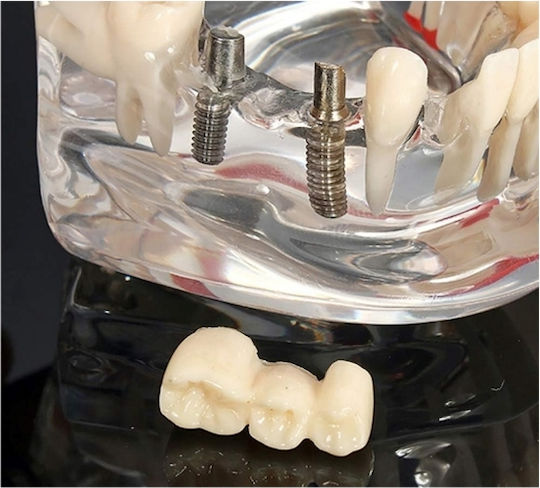 Model Dentar Anatomie Maxilară Dinți