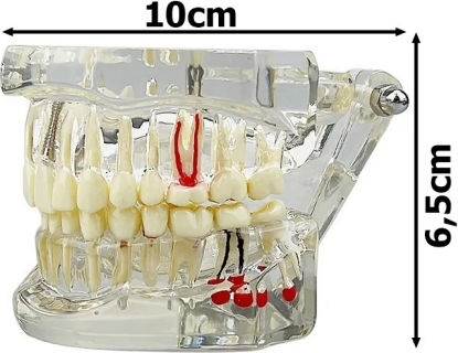 Model Dentar Anatomie Maxilară Dinți
