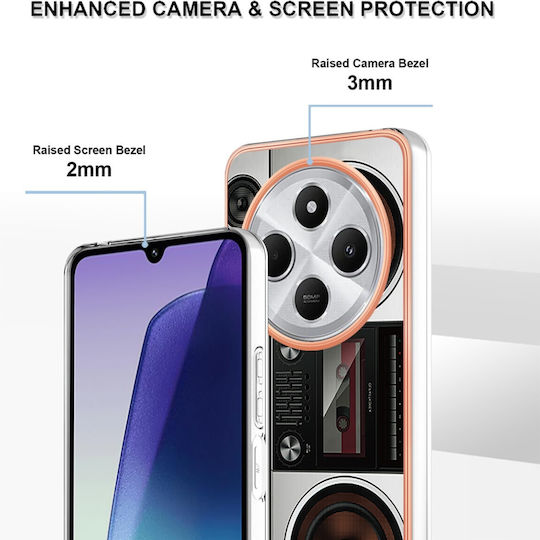 Forcell Xiaomi Redmi 14c 4g Poco C75 Husă Rigidă Cu Model Electroplacat