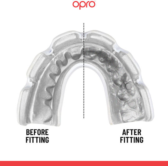 Mouth Guard Opro Instant Custom-Fit Braces Adults Gold White