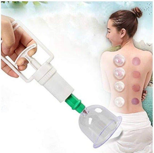 Set of 18 Traditional Therapy Suction Cups