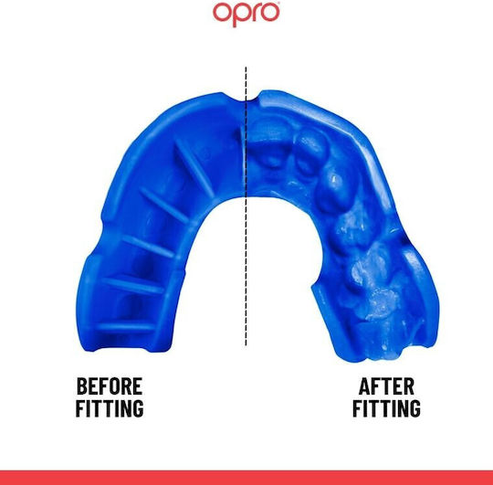 Opro Silver Edition V2 Selbstanpassbare Schutzmaske für den Mund Rot Blau