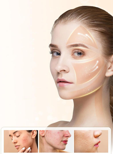 Συσκευή Microneedling B0DHXM3CXG