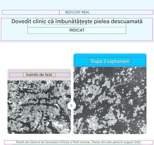Eqqualberry Dischete Tonice Pentru Față cu Centella Asiatica, Niacinamidă & Pantenol 300ml