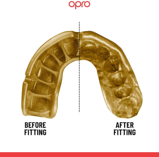 Mouthguard Opro Gold Level Self-Fit Youth Mouthguard Black Gold