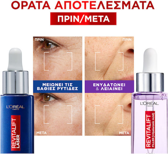 L'Oreal Paris Σετ Περιποίησης για Αντιγήρανση