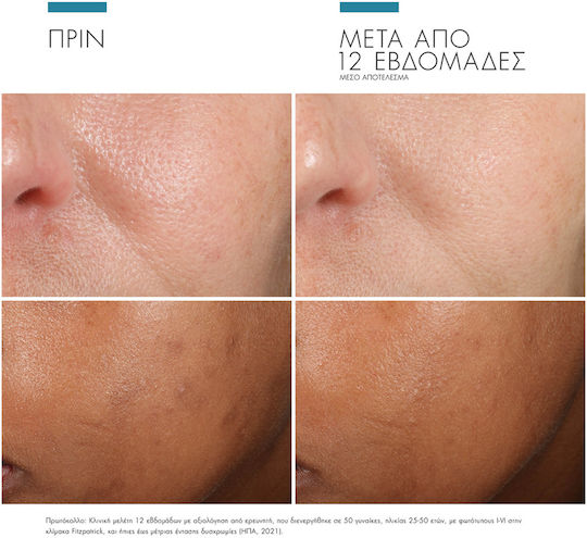 SkinCeuticals Phloretin CF Ενυδατικό & Αντιγηραντικό Serum Προσώπου με Βιταμίνη C & Υαλουρονικό Οξύ για Αποτοξίνωση & Λάμψη 30ml