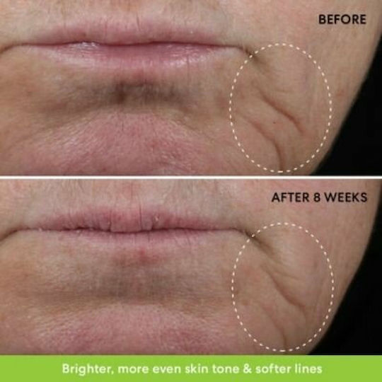 Anti-wrinkle Cream Healing Pharma Tretiheal Anti-acne Tretinoin 0.025% 20g