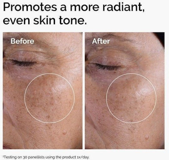 The Ordinary Glycolic Acid 7% Υγρό Τόνωσης Προσώπου με Γλυκολικό Οξύ για Όλους τους Τύπους 240ml