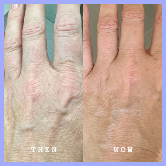 Frank Body Loțiune Hidratantă de Corp Împotriva Petelor Pigmentare cu Retinol 140ml
