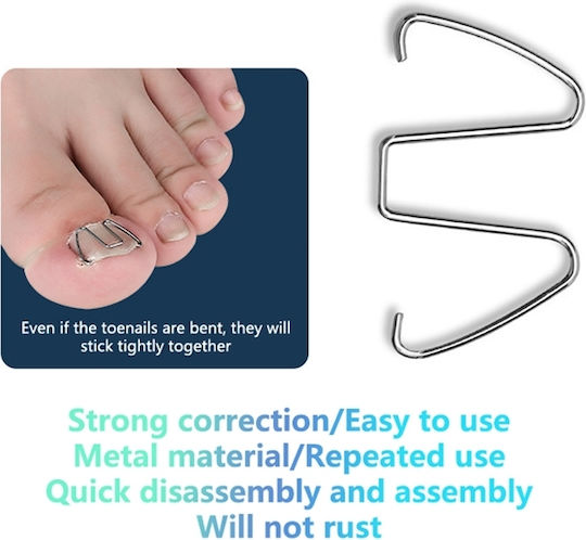 Set 6 Correctors 30 Elastic Bands Ingrown Nails Silver