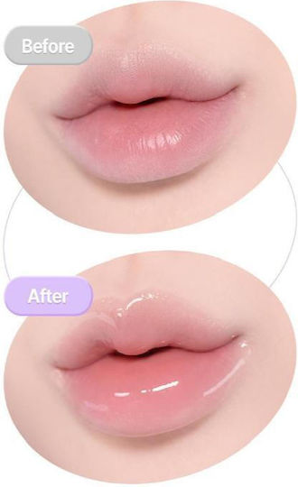 BIOHEAL BOH Lip Balm