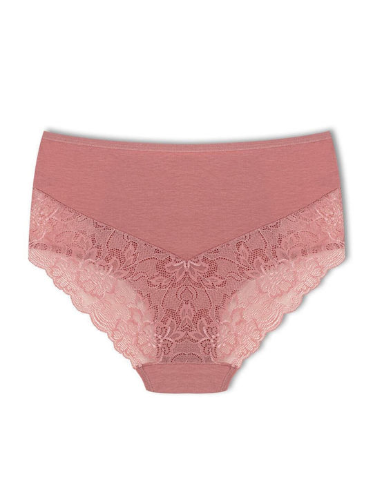 Baumwolle Hohe Taille Damen-Slips 3Pack mit Spitze Gelbe