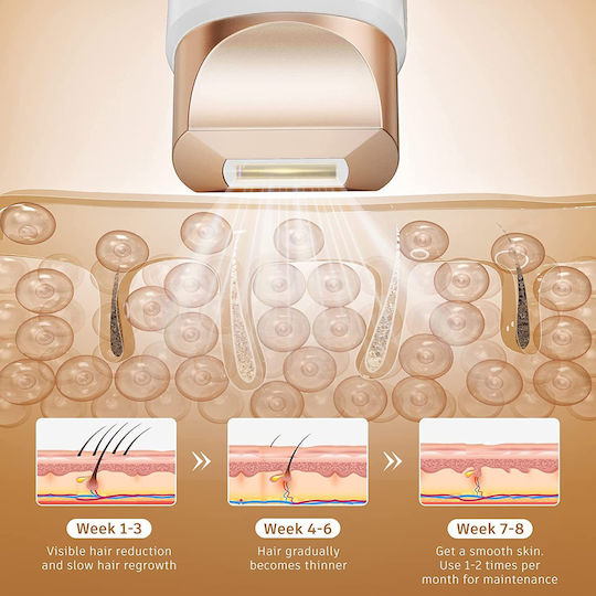 Aminzer Epilator IPL X001QG9PR9