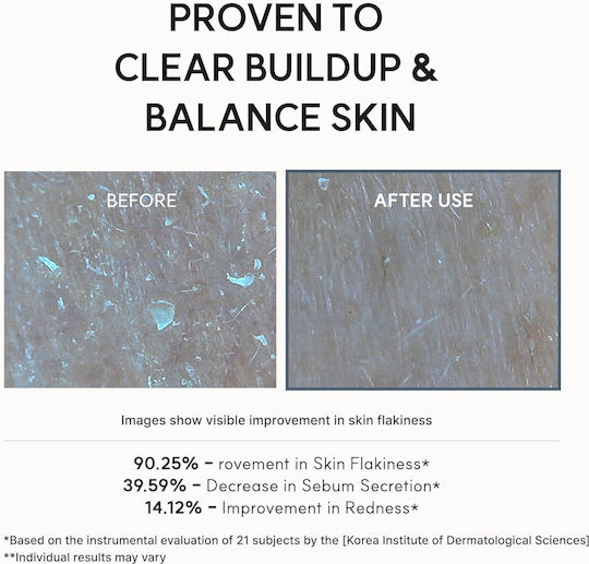 Arencia Eraser Shot Glycolic Acid Booster Light Face Cream for Blemishes with Niacinamide & AHA 30ml